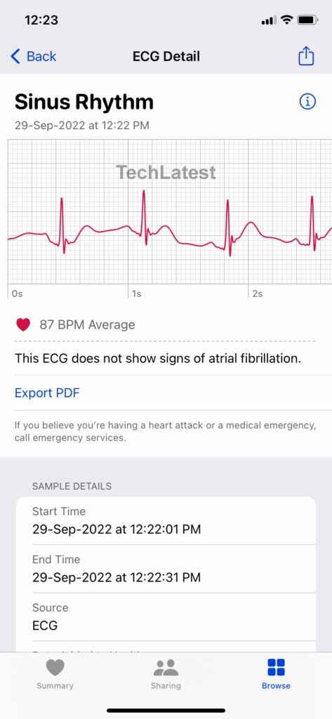 Apple Watch ECG