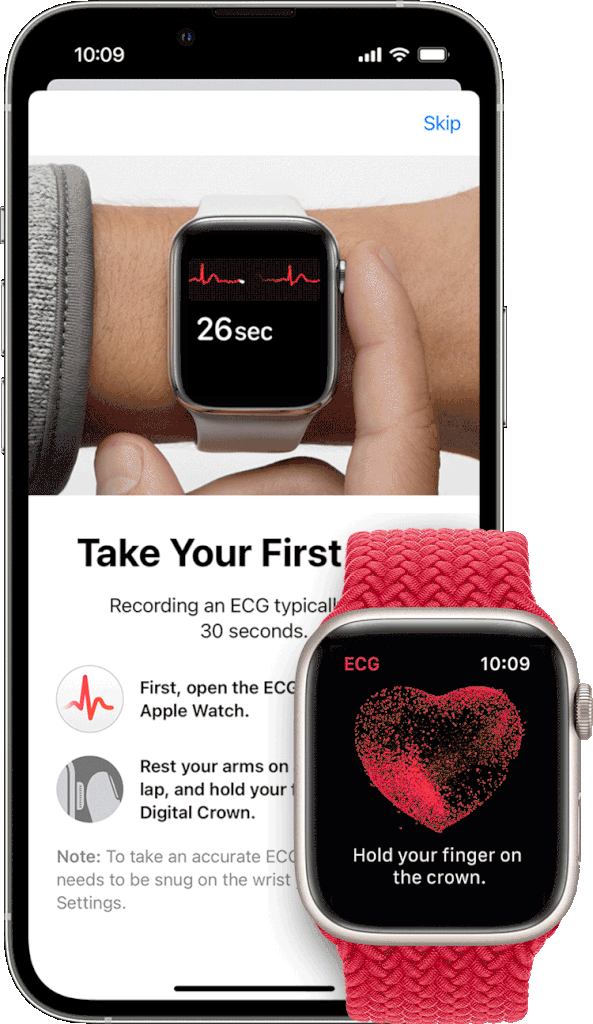 Apple Watch ECG