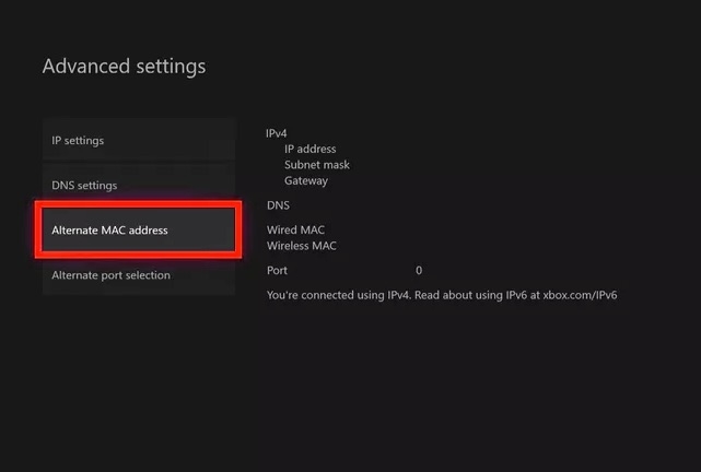 How to Fix if Xbox not Connecting to the Internet  - 49